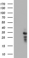 HDHD1 Antibody - HEK293T cells were transfected with the pCMV6-ENTRY control (Left lane) or pCMV6-ENTRY HDHD1 (Right lane) cDNA for 48 hrs and lysed. Equivalent amounts of cell lysates (5 ug per lane) were separated by SDS-PAGE and immunoblotted with anti-HDHD1.
