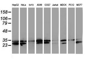 HDHD1 Antibody - Western blot of extracts (35 ug) from 9 different cell lines by using anti-HDHD1 monoclonal antibody.