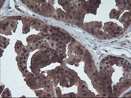 HDHD1 Antibody - IHC of paraffin-embedded Human breast tissue using anti-HDHD1 mouse monoclonal antibody.