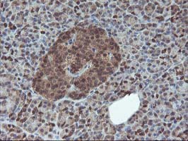 HDHD1 Antibody - IHC of paraffin-embedded Human pancreas tissue using anti-HDHD1 mouse monoclonal antibody.