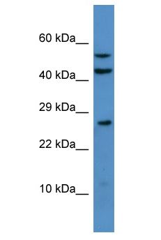 HDHD2 Antibody - HDHD2 antibody Western Blot of Rat Liver. Antibody dilution: 1 ug/ml.  This image was taken for the unconjugated form of this product. Other forms have not been tested.