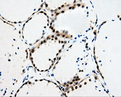 HDHD2 Antibody - Immunohistochemical staining of paraffin-embedded thyroid tissue using anti-HDHD2 mouse monoclonal antibody. (Dilution 1:50).