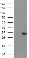 HDHD2 Antibody - HEK293T cells were transfected with the pCMV6-ENTRY control (Left lane) or pCMV6-ENTRY HDHD2 (Right lane) cDNA for 48 hrs and lysed. Equivalent amounts of cell lysates (5 ug per lane) were separated by SDS-PAGE and immunoblotted with anti-HDHD2.