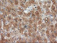 HDHD2 Antibody - IHC of paraffin-embedded Human liver tissue using anti-HDHD2 mouse monoclonal antibody.