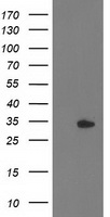 HDHD2 Antibody - HEK293T cells were transfected with the pCMV6-ENTRY control (Left lane) or pCMV6-ENTRY HDHD2 (Right lane) cDNA for 48 hrs and lysed. Equivalent amounts of cell lysates (5 ug per lane) were separated by SDS-PAGE and immunoblotted with anti-HDHD2.