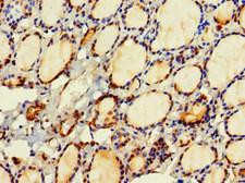 HDHD2 Antibody - Immunohistochemistry of paraffin-embedded human thyroid tissue at dilution 1:100