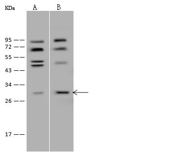 HDHD2 Antibody - Anti-HDHD2 rabbit polyclonal antibody at 1:500 dilution. Lane A: HeLa Whole Cell Lysate. Lane B: Jurkat Whole Cell Lysate. Lysates/proteins at 30 ug per lane. Secondary: Goat Anti-Rabbit IgG (H+L)/HRP at 1/10000 dilution. Developed using the ECL technique. Performed under reducing conditions. Predicted band size: 29 kDa. Observed band size: 29 kDa.
