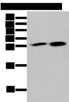 HDHD2 Antibody - Western blot analysis of 293T and 231 cell lysates  using HDHD2 Polyclonal Antibody at dilution of 1:400