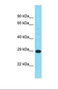 HDHD3 Antibody - Western blot of Human MCF8. HDHD3 antibody dilution 1.0 ug/ml.  This image was taken for the unconjugated form of this product. Other forms have not been tested.
