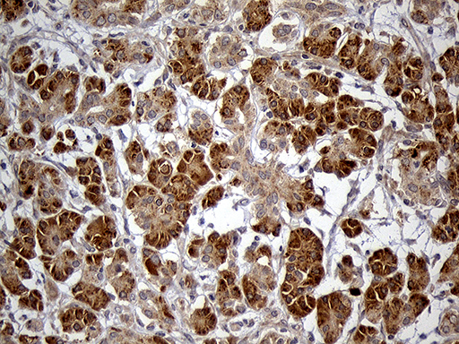 HDHD3 Antibody - Immunohistochemical staining of paraffin-embedded Human pancreas tissue within the normal limits using anti-HDHD3 mouse monoclonal antibody. (Heat-induced epitope retrieval by 1mM EDTA in 10mM Tris buffer. (pH8.5) at 120°C for 3 min. (1:150)