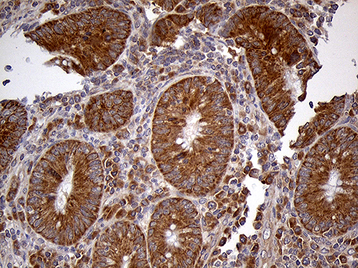 HDHD3 Antibody - Immunohistochemical staining of paraffin-embedded Human appendix tissue within the normal limits using anti-HDHD3 mouse monoclonal antibody. (Heat-induced epitope retrieval by 1mM EDTA in 10mM Tris buffer. (pH8.5) at 120°C for 3 min. (1:150)