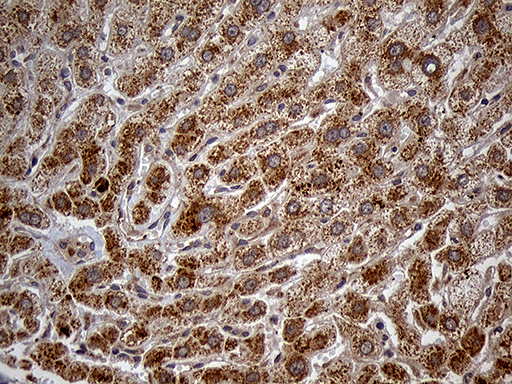 HDHD3 Antibody - Immunohistochemical staining of paraffin-embedded Human liver tissue within the normal limits using anti-HDHD3 mouse monoclonal antibody. (Heat-induced epitope retrieval by 1mM EDTA in 10mM Tris buffer. (pH8.5) at 120°C for 3 min. (1:150)