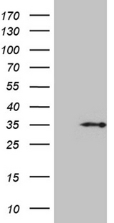HDHD3 Antibody - HEK293T cells were transfected with the pCMV6-ENTRY control. (Left lane) or pCMV6-ENTRY HDHD3. (Right lane) cDNA for 48 hrs and lysed. Equivalent amounts of cell lysates. (5 ug per lane) were separated by SDS-PAGE and immunoblotted with anti-HDHD3. (1:500)