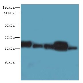 HDHD3 Antibody - Western blot. All lanes: HDHD3 antibody at 1 ug/ml. Lane 1: Mouse small intestine tissue. Lane 2: HT29 whole cell lysate. Lane 3: Mouse liver tissue. Lane 4: HepG-2 whole cell lysate. Lane 5: A431 whole cell lysate. Secondary antibody: Goat polyclonal to Rabbit IgG at 1:10000 dilution. Predicted band size: 28 kDa. Observed band size: 28 kDa.