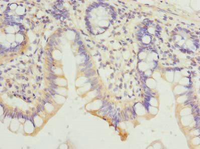 HDHD3 Antibody - Immunohistochemistry of paraffin-embedded human small intestine tissue using HDHD3 Antibody at dilution of 1:100