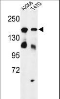 HDLBP / Vigilin Antibody - Western blot of HDLBP Antibody in A2058, T47D cell line lysates (35 ug/lane). HDLBP (arrow) was detected using the purified antibody.