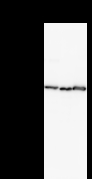 HDLBP / Vigilin Antibody - Detection of HDLBP by Western blot. Samples: Whole cell lysate from human HEK293 (H, 25 ug) , mouse NIH3T3 (M, 25 ug) and rat F2408 (R, 25 ug) cells. Predicted molecular weight: 141 kDa