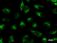 HDLBP / Vigilin Antibody - Immunostaining analysis in HeLa cells. HeLa cells were fixed with 4% paraformaldehyde and permeabilized with 0.1% Triton X-100 in PBS. The cells were immunostained with anti-HDLBP mAb.