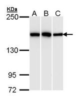 HDLBP / Vigilin Antibody - Sample (30 ug of whole cell lysate). A: Hela. B: Hep G2. C: Raji. 5% SDS PAGE. HDLBP antibody diluted at 1:1000. 