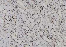 HDLBP / Vigilin Antibody - 1:100 staining human kidney tissue by IHC-P. The sample was formaldehyde fixed and a heat mediated antigen retrieval step in citrate buffer was performed. The sample was then blocked and incubated with the antibody for 1.5 hours at 22°C. An HRP conjugated goat anti-rabbit antibody was used as the secondary.