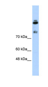 HDLBP / Vigilin Antibody - HDLBP antibody Western blot of Jurkat lysate. This image was taken for the unconjugated form of this product. Other forms have not been tested.