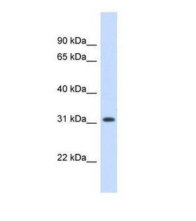 HDS / DHDDS Antibody - Western blot of Human 293T. DHDDS antibody dilution 1.0 ug/ml.  This image was taken for the unconjugated form of this product. Other forms have not been tested.