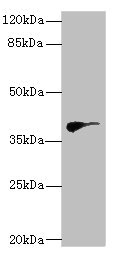 HDS / DHDDS Antibody - Western blot All Lanes: DHDDSantibody at 2.97ug/ml+ Hela whole cell lysate Goat polyclonal to rabbit at 1/10000 dilution Predicted band size: 39,35 kDa Observed band size: 39 kDa