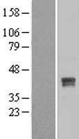 HDS / DHDDS Protein - Western validation with an anti-DDK antibody * L: Control HEK293 lysate R: Over-expression lysate