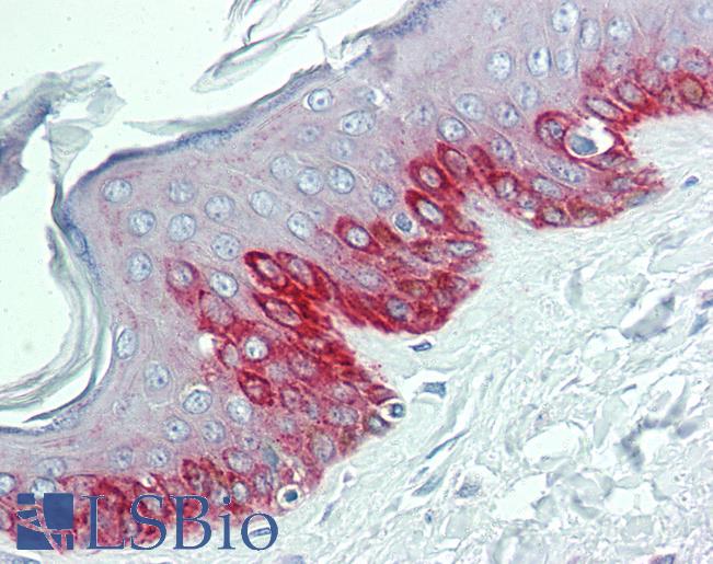 HDX Antibody - Anti-HDX antibody IHC of human skin. Immunohistochemistry of formalin-fixed, paraffin-embedded tissue after heat-induced antigen retrieval. Antibody concentration 5 ug/ml.  This image was taken for the unconjugated form of this product. Other forms have not been tested.