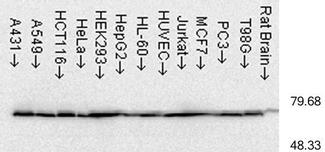 Heat Shock Protein 70 / HSPA1A Antibody - Immunoblotting of Hsp70 in cell lysates from human cancer cell lines