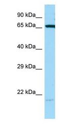 Heat Shock Protein 70 / HSPA1A Antibody - HSPA1B antibody Western Blot of MDA-MB-435S.  This image was taken for the unconjugated form of this product. Other forms have not been tested.
