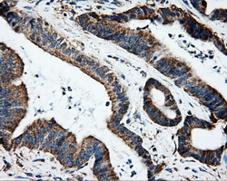 Heat Shock Protein 70 / HSPA1A Antibody - Immunohistochemical staining of paraffin-embedded liver tissue using anti-HSPA1A mouse monoclonal antibody. (Dilution 1:50).