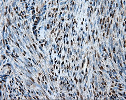 Heat Shock Protein 70 / HSPA1A Antibody - Immunohistochemical staining of paraffin-embedded endometrium tissue using anti-HSPA1A mouse monoclonal antibody. (Dilution 1:50).