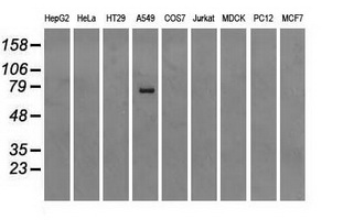 Heat Shock Protein 70 / HSPA1A Antibody - Western blot analysis of extracts (35ug) from 9 different cell lines by using anti-HSPA1A monoclonal antibody.