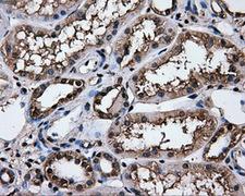 Heat Shock Protein 70 / HSPA1A Antibody - Immunohistochemical staining of paraffin-embedded Kidney tissue using anti-HSPA1A mouse monoclonal antibody. (Dilution 1:50).