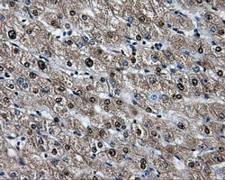 Heat Shock Protein 70 / HSPA1A Antibody - Immunohistochemical staining of paraffin-embedded liver tissue using anti-HSPA1A mouse monoclonal antibody. (Dilution 1:50).