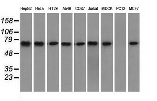 Heat Shock Protein 70 / HSPA1A Antibody - Western blot of extracts (35 ug) from 9 different cell lines by using anti-HSPA1A monoclonal antibody.