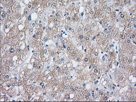 Heat Shock Protein 70 / HSPA1A Antibody - IHC of paraffin-embedded Human liver tissue using anti-HSPA1A mouse monoclonal antibody. (Dilution 1:50).