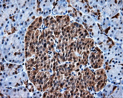 Heat Shock Protein 70 / HSPA1A Antibody - Immunohistochemical staining of paraffin-embedded pancreas tissue using anti-HSPA1A mouse monoclonal antibody. (Dilution 1:50).