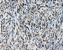 Heat Shock Protein 70 / HSPA1A Antibody - Immunohistochemical staining of paraffin-embedded endometrium tissue using anti-HSPA1A mouse monoclonal antibody. (Dilution 1:50).