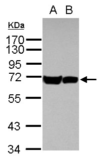 Heat Shock Protein 70 / HSPA1A Antibody - Sample (30 ug of whole cell lysate) A: A431 B: HeLa 7.5% SDS PAGE HSPA1B antibody diluted at 1:1000