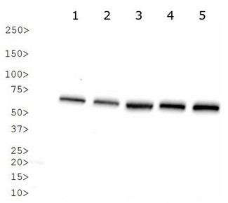 Heat Shock Protein 70 / HSPA1A Antibody - Western Blot: Hsp70 Antibody - Analysis of HSP70 in: 1. human brain, 2. human liver, 3. human testes, 4. human skeletal muscle and 5. human heart.  This image was taken for the unconjugated form of this product. Other forms have not been tested.