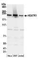 HEATR1 Antibody - Detection of human HEATR1 by western blot. Samples: Whole cell lysate (50 µg) from HeLa, HEK293T, and Jurkat cells prepared using NETN lysis buffer. Antibody: Affinity purified rabbit anti-HEATR1 antibody used for WB at 0.04 µg/ml. Detection: Chemiluminescence with an exposure time of 30 seconds.