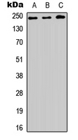 HEATR1 Antibody - Western blot analysis of BAP28 expression in HEK293T (A); NS-1 (B); PC12 (C) whole cell lysates.