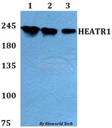HEATR1 Antibody - Western blot of HEATR1 antibody at 1:500 dilution. Lane 1: HEK293T whole cell lysate. Lane 2: sp2/0 whole cell lysate. Lane 3: PC12 whole cell lysate.