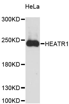 HEATR1 Antibody - Western blot analysis of extracts of HeLa cells, using HEATR1 antibody at 1:3000 dilution. The secondary antibody used was an HRP Goat Anti-Rabbit IgG (H+L) at 1:10000 dilution. Lysates were loaded 25ug per lane and 3% nonfat dry milk in TBST was used for blocking. An ECL Kit was used for detection and the exposure time was 90s.