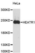 HEATR1 Antibody - Western blot analysis of extracts of HeLa cells, using HEATR1 antibody at 1:3000 dilution. The secondary antibody used was an HRP Goat Anti-Rabbit IgG (H+L) at 1:10000 dilution. Lysates were loaded 25ug per lane and 3% nonfat dry milk in TBST was used for blocking. An ECL Kit was used for detection and the exposure time was 90s.