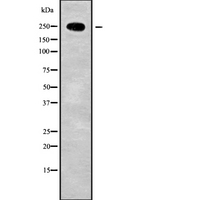 HEATR1 Antibody - Western blot analysis of HEATR1 using Jurkat whole cells lysates