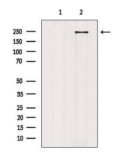 HEATR1 Antibody - Western blot analysis of extracts of mouse brain tissue using HEATR1 antibody. Lane 1 was treated with the blocking peptide.