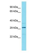 HEATR3 Antibody - HEATR3 antibody Western Blot of Fetal Kidney. Antibody dilution: 1 ug/ml.  This image was taken for the unconjugated form of this product. Other forms have not been tested.